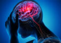 تحریک نخاع به بازیابی قدرت بازو پس از سکته مغزی کمک می کند