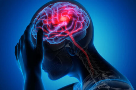 تحریک نخاع به بازیابی قدرت بازو پس از سکته مغزی کمک می کند تحریک نخاع به بازیابی قدرت بازو پس از سکته مغزی کمک می کند
